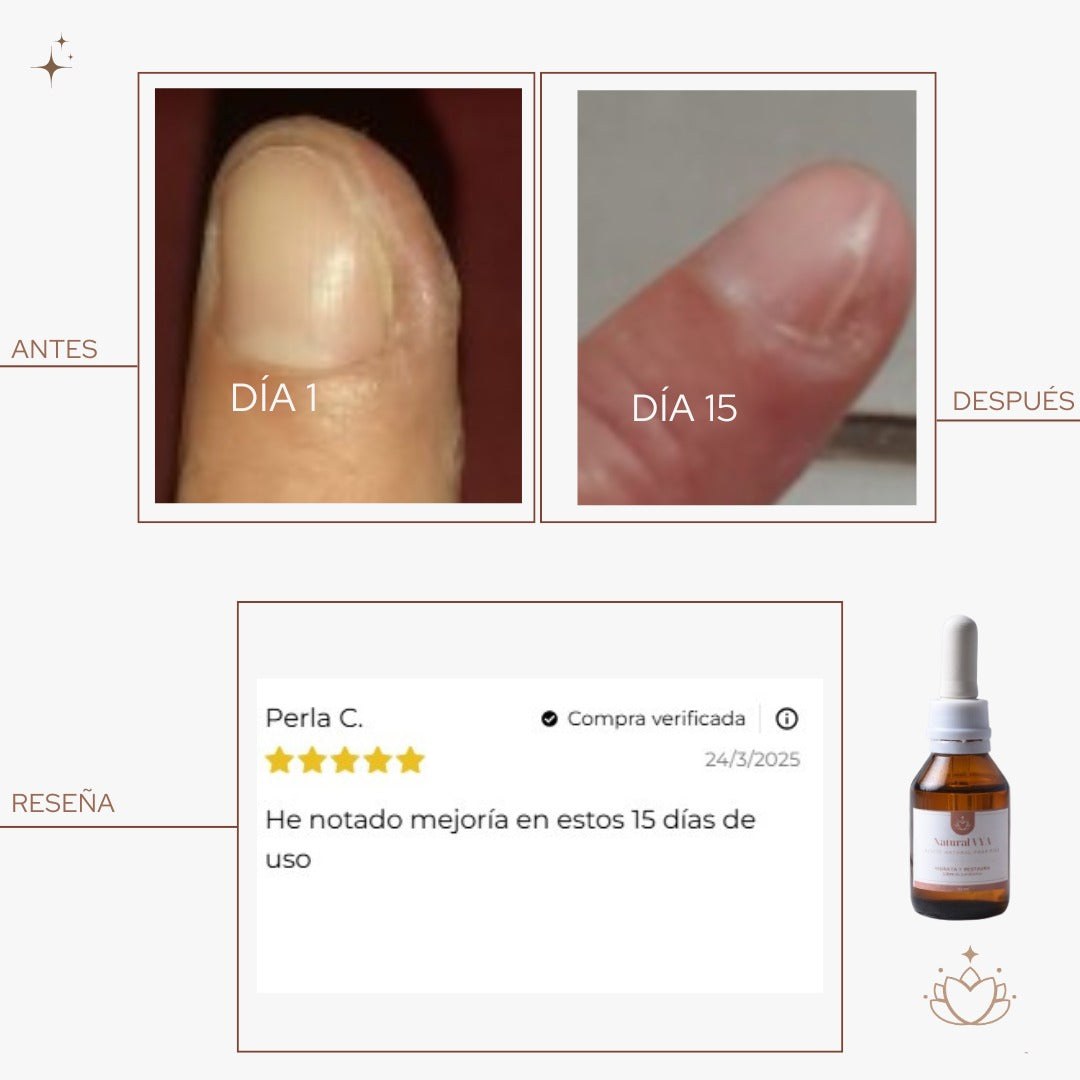 Aceite Antihongos para Pies - Recupera la apariencia sana de tus uñas en casa