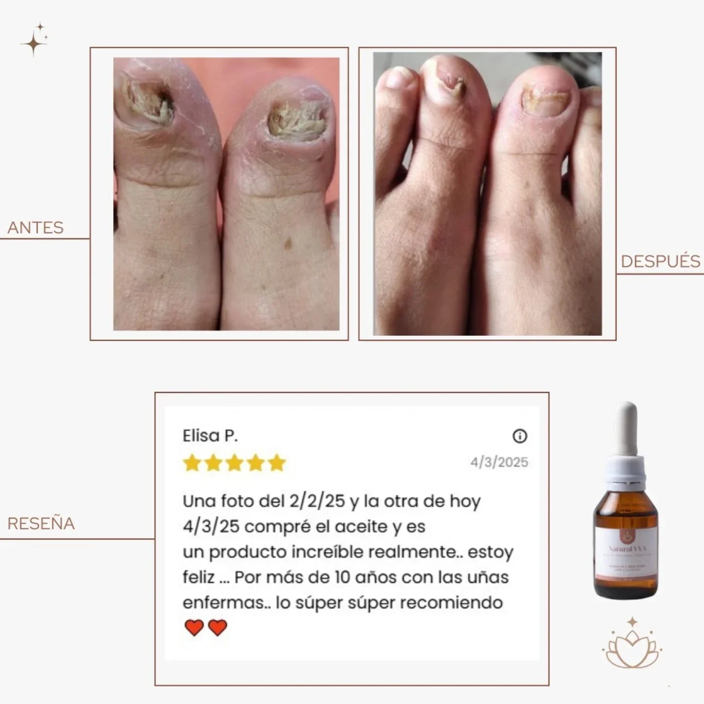 Aceite Antihongos para Pies - Recupera la apariencia sana de tus uñas en casa